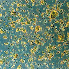 Foto z mikroskopu ukazující hrudkovité krystaly nezpracované Q10 suroviny