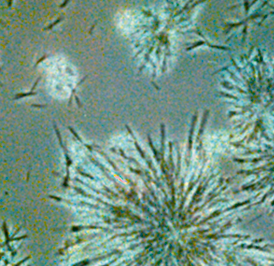 Foto z mikroskopu ukazující zpracované krystaly Bioaktivní Q10 ve tvaru sněhových vloček